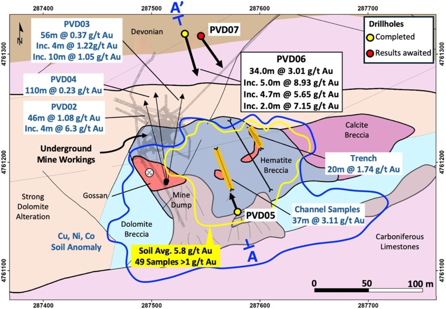 Figure 1 – Summary Geology map and drillhole locations; A – A’ cross section location (CNW Group/Pan Global Resources Inc.)